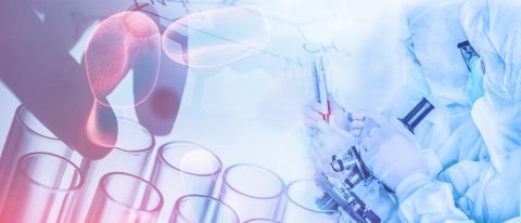 Erasmus Mundus Joint Master - ChEMoinformatics+ : AlphaFold2 : A brilliant Project 